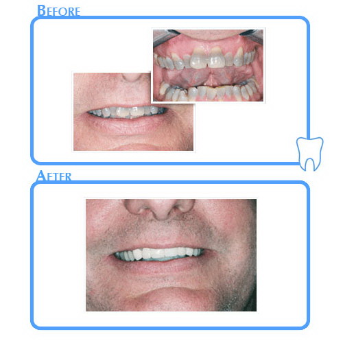 Cosmetic Dentistry