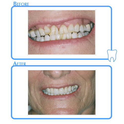 Cosmetic Dentistry