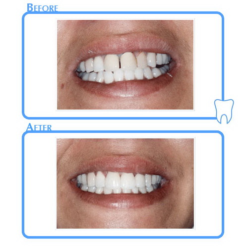 Cosmetic Dentistry