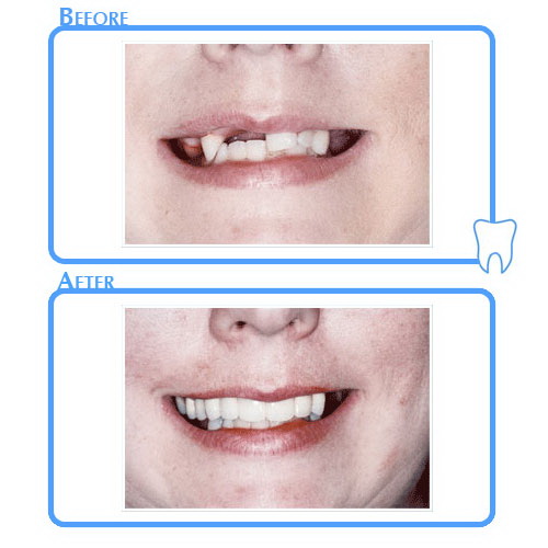 Cosmetic Dentistry