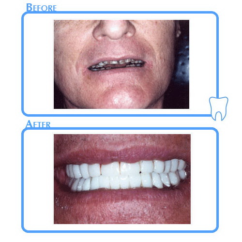 Cosmetic Dentistry