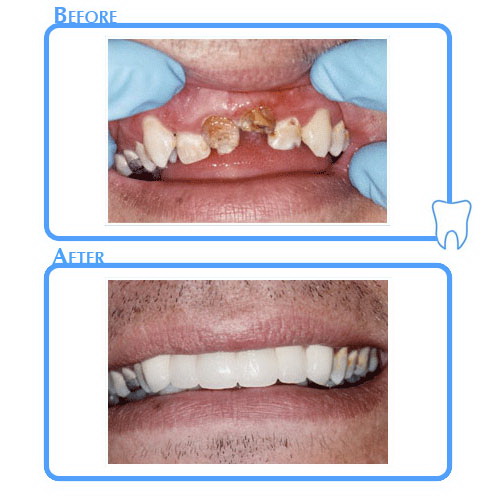 Cosmetic Dentistry